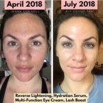 Rodan + Fields Ultimate Skin Care