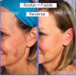 Rodan + Fields Ultimate Skin Care
