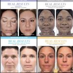 Rodan + Fields Ultimate Skin Care